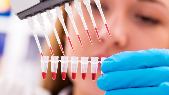 woman assistant in laboratory with multi pipette in the clinic,